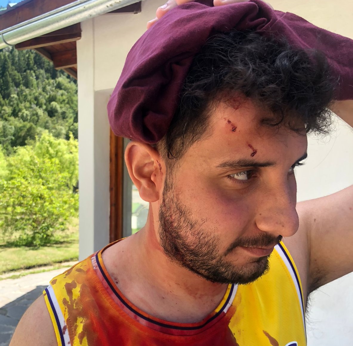 Uno de los jóvenes que fue agredido el viernes en Villa Mascardi. Foto: gentileza