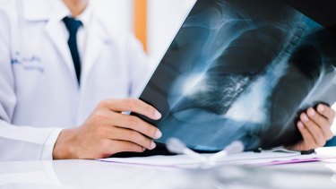 En Argentina fallecen más de 60 mil personas al año debido a algún tipo de cáncer. 