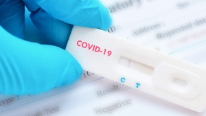 Qué diferencia hay entre los test para detectar el coronavirus y cuándo se utilizan
