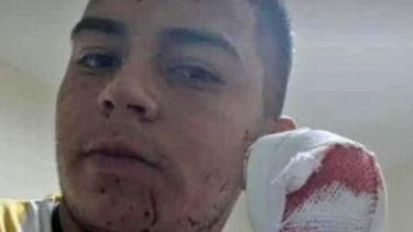 El repartidor tucumano perdió cuatro dedos de su mano izquierda tras el violento asalto.