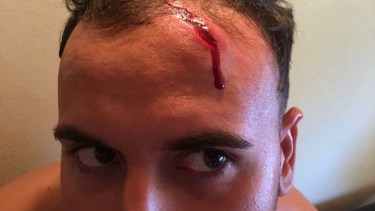 Brutal agresión de encapuchados a dos turistas en Villa Mascardi