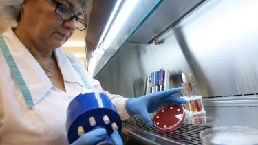 Los autores advierten que no debe ser fuente de preocupación porque la variante puede ser respondida con los tratamientos existentes.