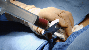 Cuando se decide donar el cordón y su sangre, debe hacerse a un banco público, al que cualquier individuo  podrá acceder.