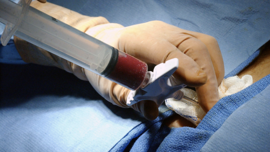 Cuando se decide donar el cordón y su sangre, debe hacerse a un banco público, al que cualquier individuo  podrá acceder.