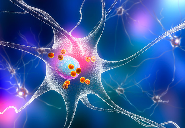 Síntomas del Parkinson. Algunos están asociados a la muerte de neuronas que producen dopamina 
