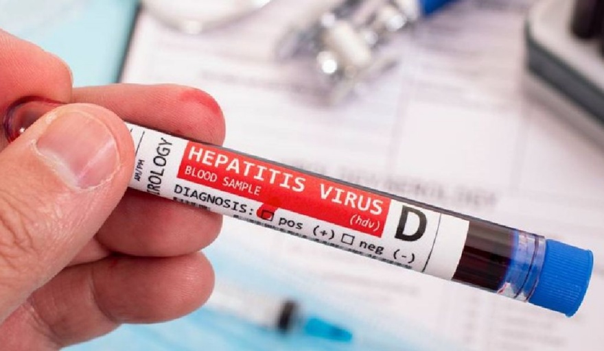 Aún investigan el origen de los casos de hepatitis.