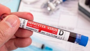 Los síntomas de la hepatitis aguda infantil: cuándo consultar al pediatra