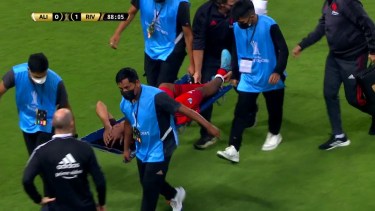 Rojas sufrió una terrible patada que le generó una fractura.