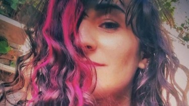 Sufrió un grave accidente en Roca y ahora necesitan reunir $350 mil para operarla