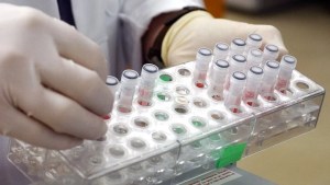 EEUU desplegará vacunas contra la viruela del mono entre la población más susceptible