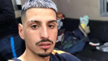 El cantante es, además, amante de las motos. Arriba de una tuvo el grave accidente.-