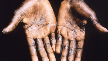 Foto: Agencia Télam.