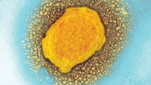 Viruela del mono: diez razones para ser optimistas