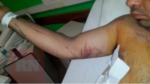 Los golpeados por policías se autolesionaron con cubiertos de plástico: es la hipótesis de la defensa