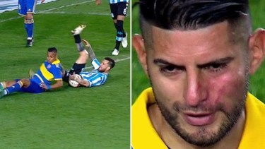 La mano de Gómez que no cobró Rapallini y las que puso Benedetto sobre el rostro de su compañero, Zambrano. 