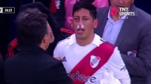 Imagen de Aliendro salió lesionado en el Boca-River: el video