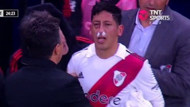 Rodrigo Aliendro entró para el segundo tiempo y unos minutos después tuvo que dejar la cancha por un golpe. 
