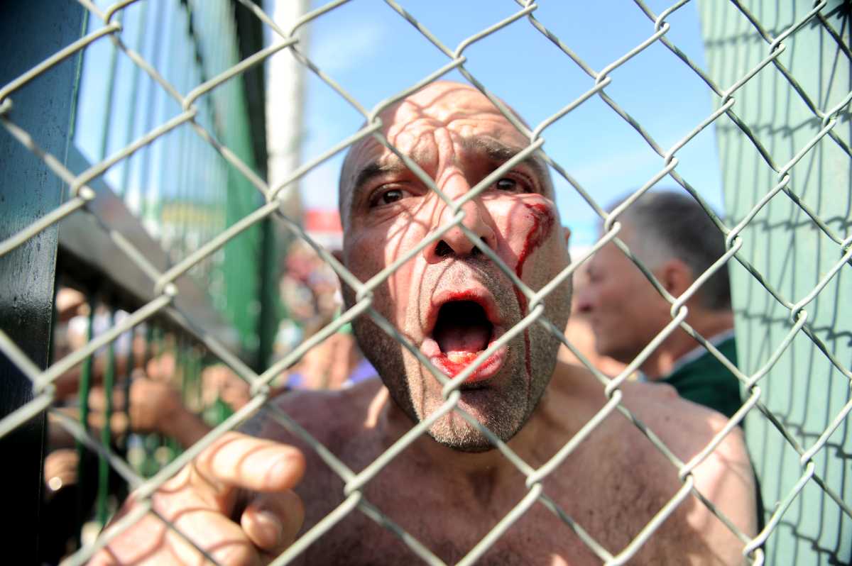 El rostro de uno de los heridos producto de las peleas en la tribuna de Sarmiento. Fotos: Télam