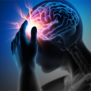 Los Accidentes Cerebro Vasculares (ACV) afectan a más de 50.000 personas en el país al año.