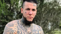 Imagen de Alex Caniggia se operó la mandíbula y mostró los resultados en redes