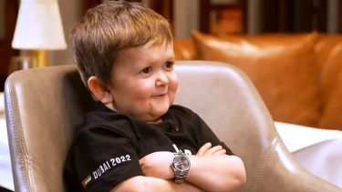 Hasbulla es un influencer y tiene acondroplasia. Esto significa que, pese a tener 20 años, tiene aspecto de niño pequeño.- 