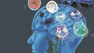 Esclerosis múltiple, un partido día a día