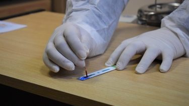 Al conocer el diagnóstico de VIH, se puede hacer a la terapia que consigue que el virus sea indetectable