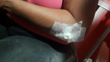 La mujer presenta heridas leves ya que el delincuente la arrastró varios metros con su moto. (foto: gentileza)