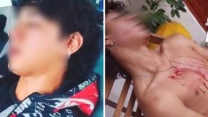 «Fue casi otro Fernando Báez Sosa»: 15 adolescentes le dieron una golpiza a un joven