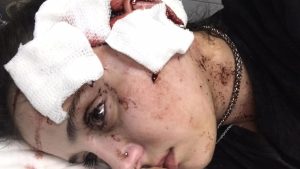 El relato de la moza agredida salvajemente por dos hombres en Mendoza: «Me arruinaron la cara»