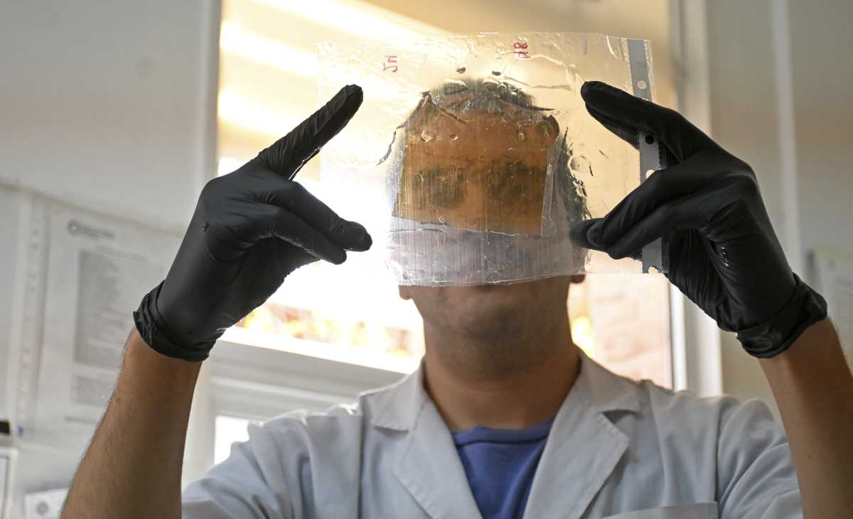 Un estudio realizado en Neuquén reveló que hay restos de plaguicidas en las placentas e investigan los efectos. Foto: Florencia Salto