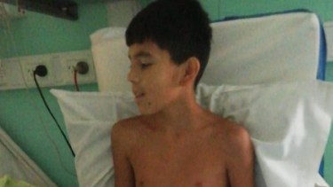 Ezequiel tuvo que ser operado más de 10 veces por el grave accidente. Foto: Captura