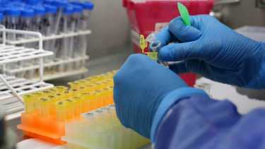 Los laboratorios bioquímicos cobran un bono a los afiliados de obras sociales y prepagas desde el mes pasado. Archivo