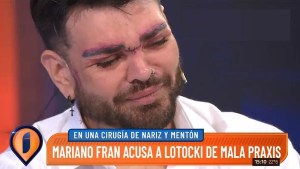 Fran Mariano se quebró en vivo al recordar la mala praxis de Aníbal Lotocki: “Me arruinó la cara”