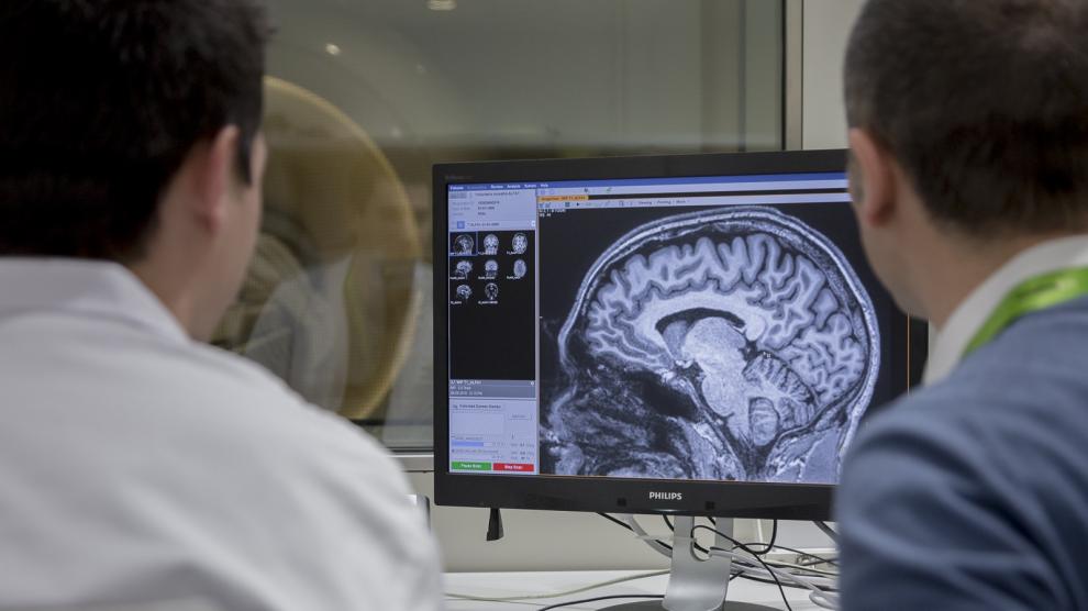 El cardiólogo Gustavo Cerezo recomendó cómo se podía cuidar el cerebro. 