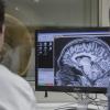 Imagen de Día Mundial del Cerebro: por qué el invierno puede afectar la salud cerebral y cómo evitarlo