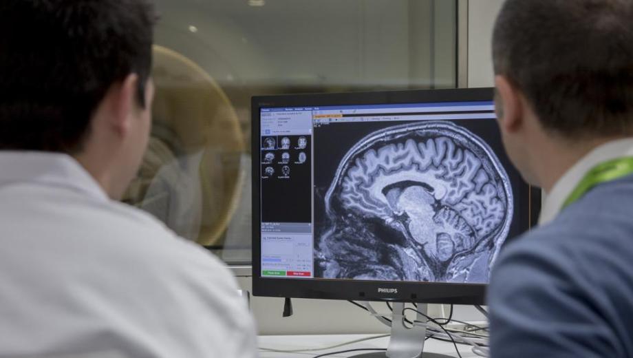 Hay hábitos que contribuyen a la salud cerebral. Foto: archivo