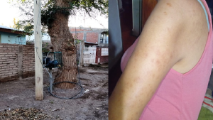 Se electrocutó con los cables sueltos de una empresa telefónica en Buta Ranquil