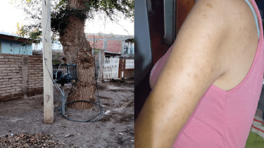 Recibió una descarga eléctrica por unos cables sueltos. foto: facebook.