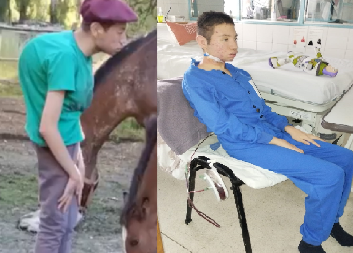 Nehuen fue operado y comienza su recuperación. Foto: facebook