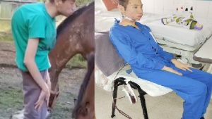 El joven de Las Lajas con escoliosis avanzada fue operado y comienza su recuperación