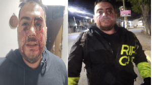 Intentaron robarle la moto, se defendió y fue golpeado, en Plottier