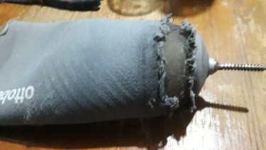 Necesita cambiar su prótesis, pero desde el ISSN no se lo autorizan. Foto: gentileza