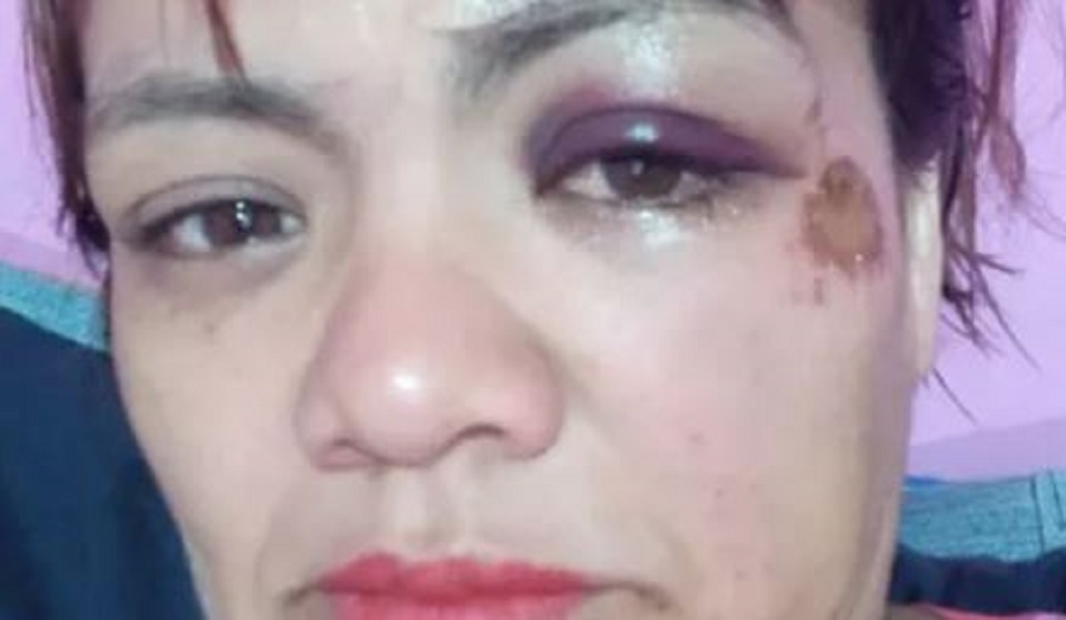 La víctima acudió por sus propios medios al hospital. Foto: https://www.diarioandino.com.ar/