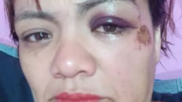 La víctima acudió por sus propios medios al hospital. Foto: https://www.diarioandino.com.ar/