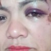 Imagen de Una jauría atacó a una mujer que circulaba en bicicleta, en Villa la Angostura