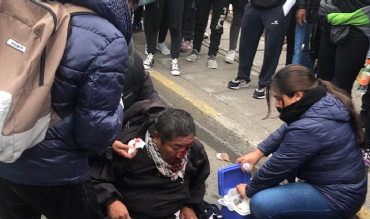 Un manifestante fue gravemente herido en el cráneo, al ser impactado por la lata de un gas lacrimógeno.-