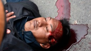 Represión en Jujuy: cómo está el manifestante herido, que compararon con Carlos Fuentealba