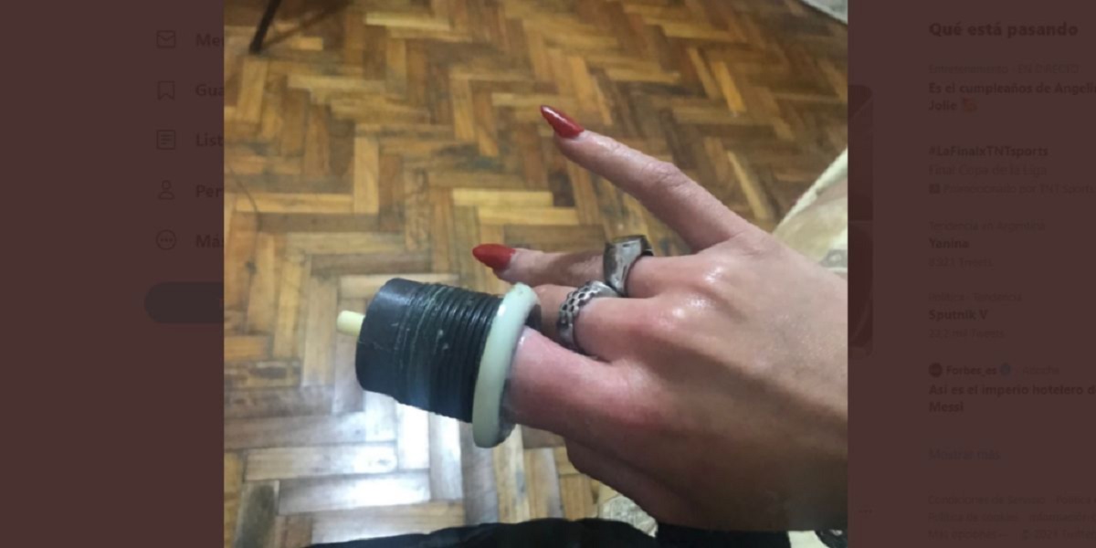 Se le quedó atascado el dedo en el inodoro y debió ser asistida por bomberos, en Centenario. Foto: Centenario Digital