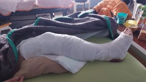 Brutal ataque en Huergo: los apedrearon y a una joven le quebraron la pierna